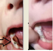 teeth